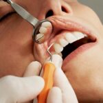 Why Dental Implants in Leicester Are Worth Considering